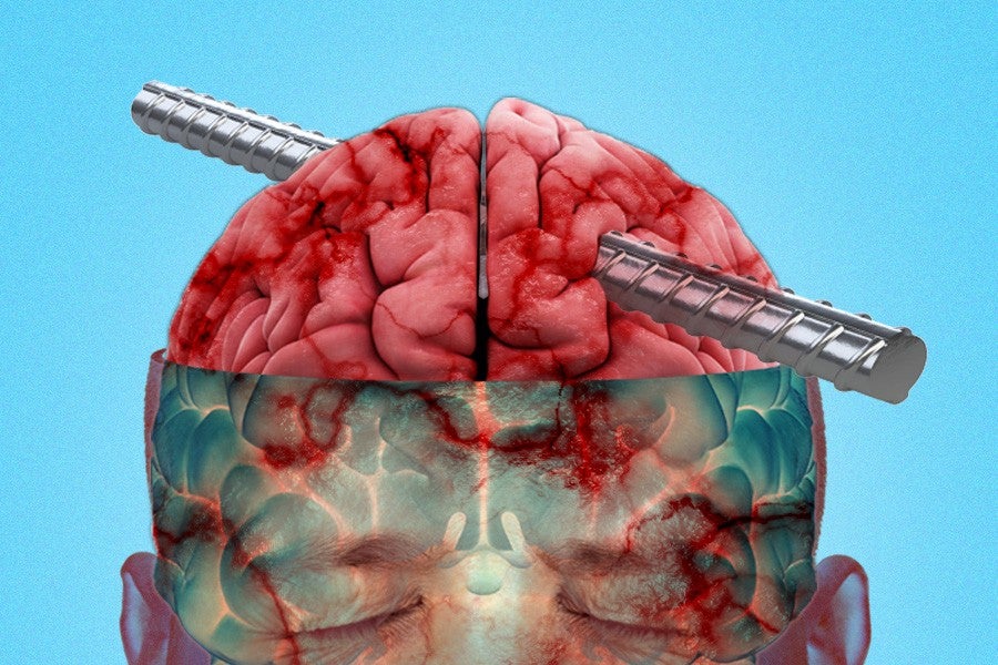 Article Thumbnail