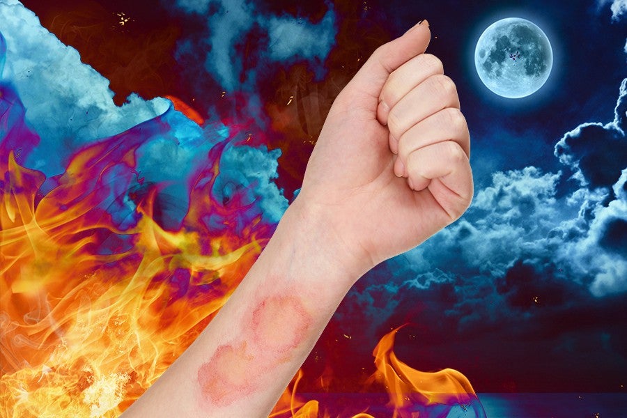 Sick Burns Take Longer to Heal Depending on the Time of Day