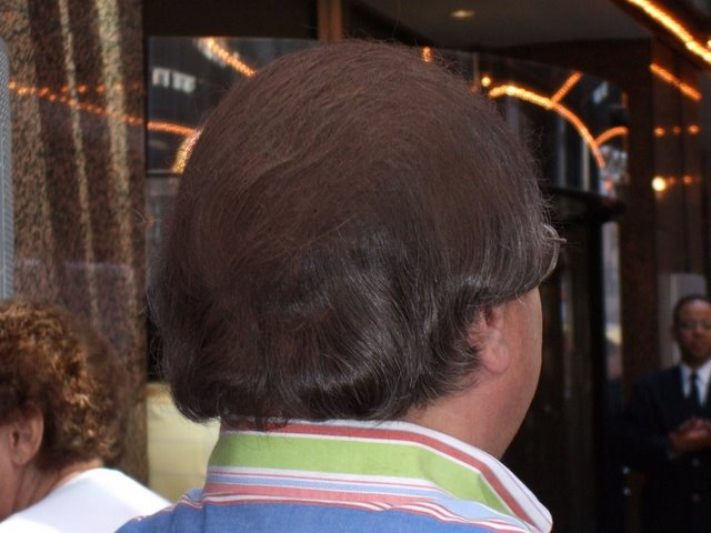 The Stories Behind the Craziest Inventions Men Have Used to Color in Their  Bald Spots