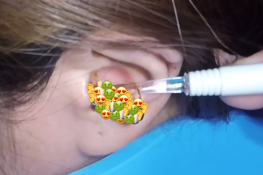 The Sweet Serenity of Earwax Extraction YouTube Videos