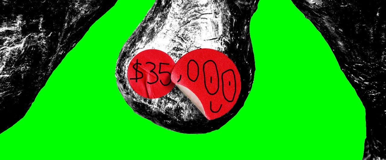 The Guy Who Tried To Sell A Testicle For 35k Is As Ballsy As Ever