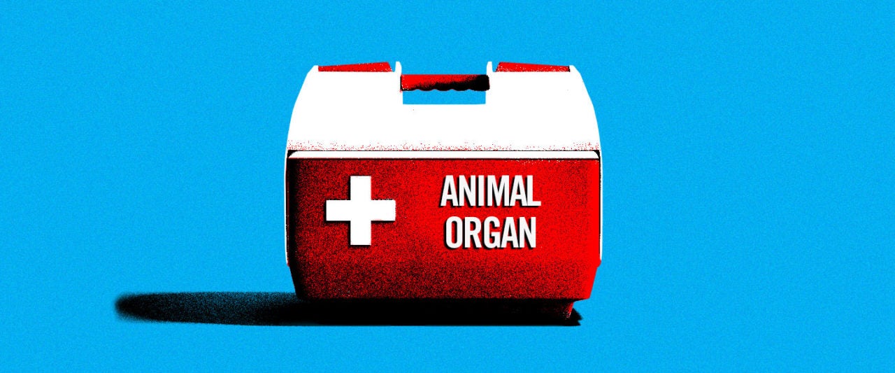 Animal Parts Are the (Near) Future of Human Organ Transplants