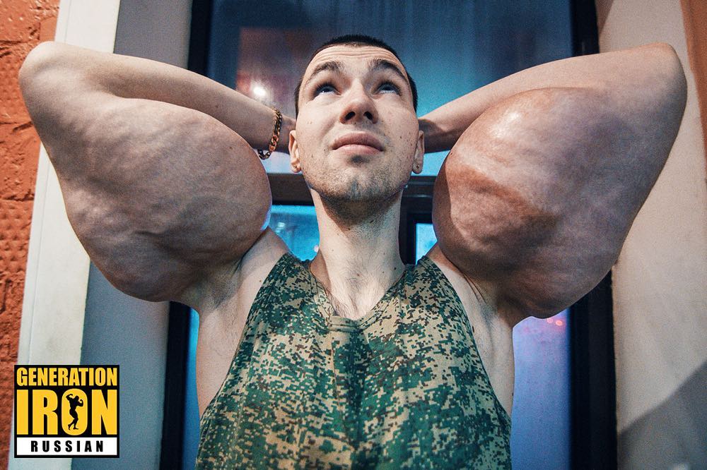 The Weird World of Synthol Bodybuilders