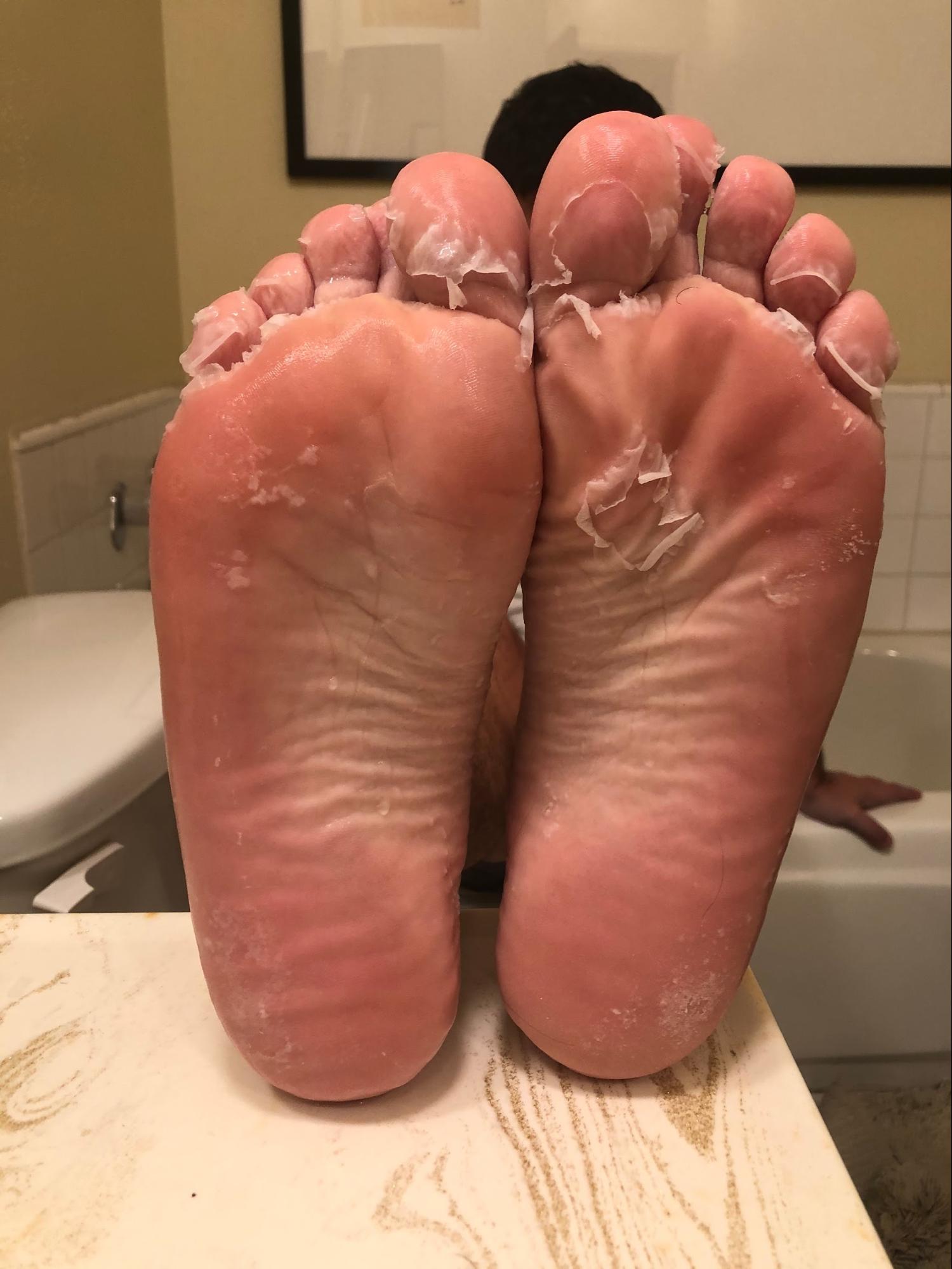 I Tried an Exfoliating Foot Peel to Transform My Feet, and It Was