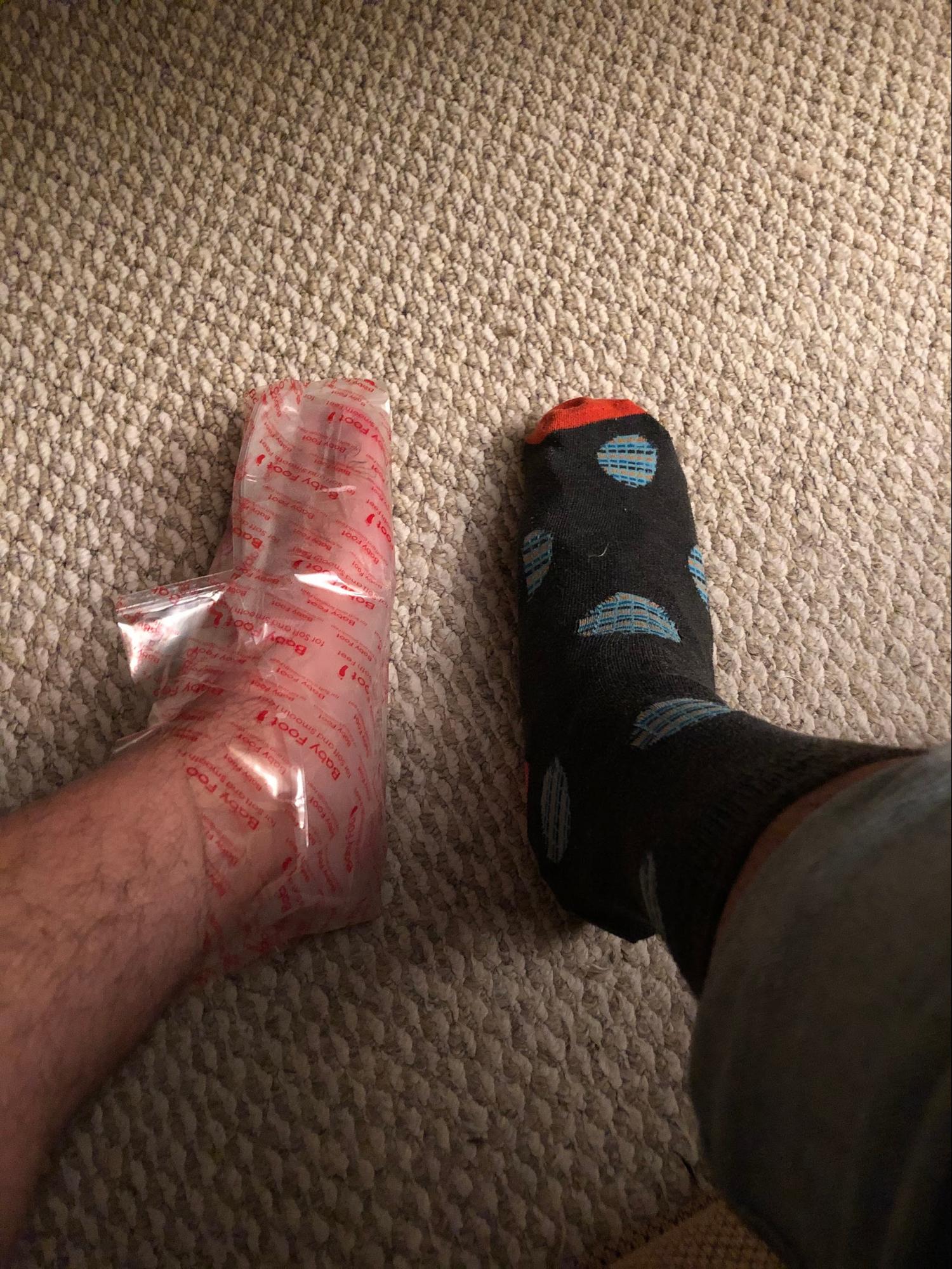 I Tried an Exfoliating Foot Peel to Transform My Feet, and It Was