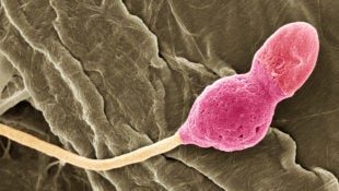 sperm_shape_speed_motility