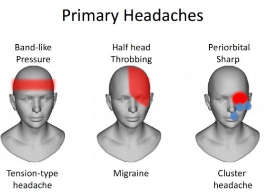 headache in the middle of my forehead and eyes