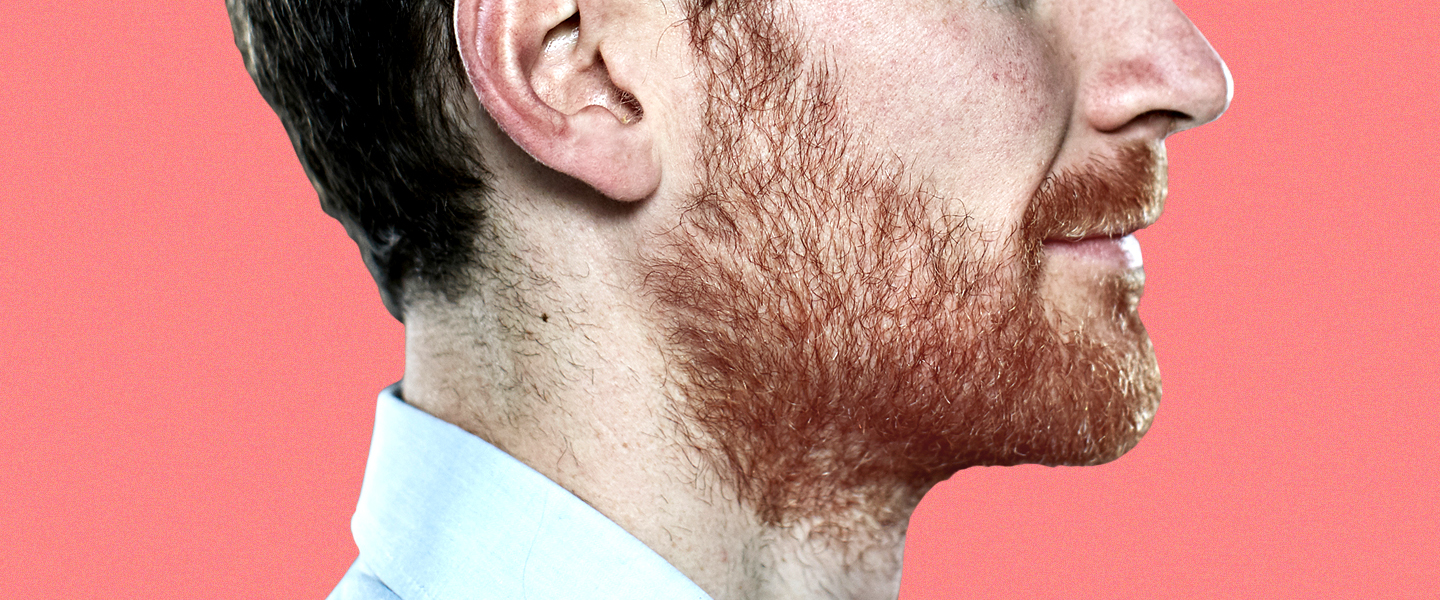 Why Do Men Get Red Hair in Their Beards?